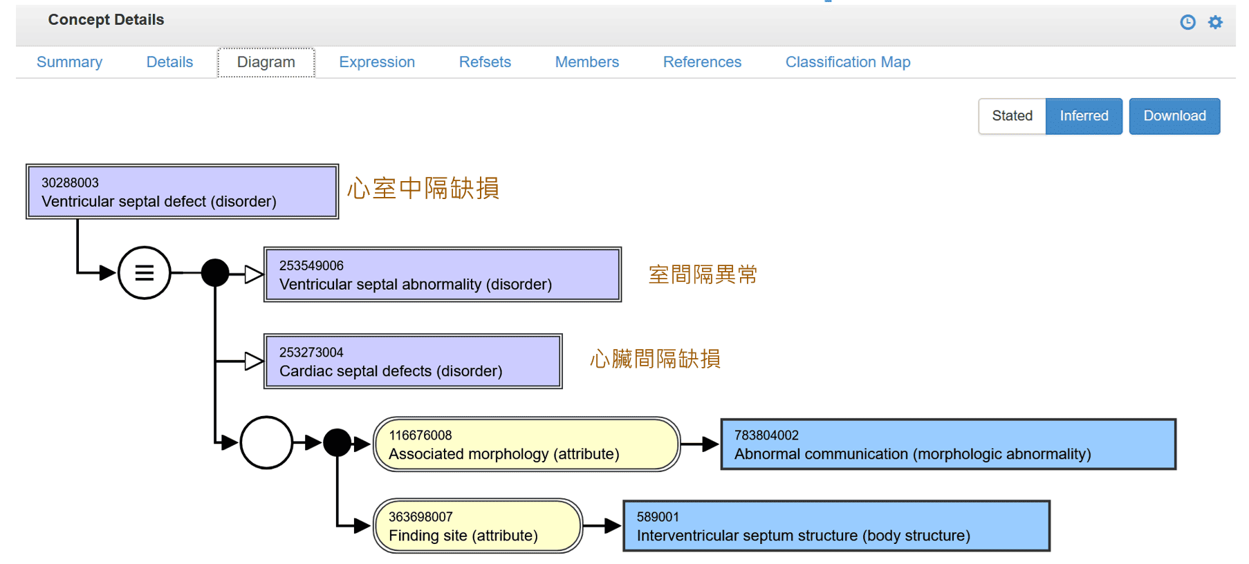 ventriculay-septal-defect-(diagram)